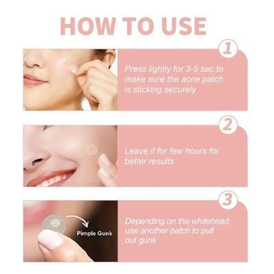 Pimple Patches - 72 Pcs