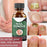 Effective Nail Fungus Treatment Serum - 1 Pc for Fast Relief